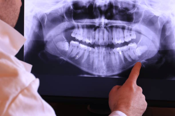 Best Knocked-Out Tooth Emergency  in Columbia, SC