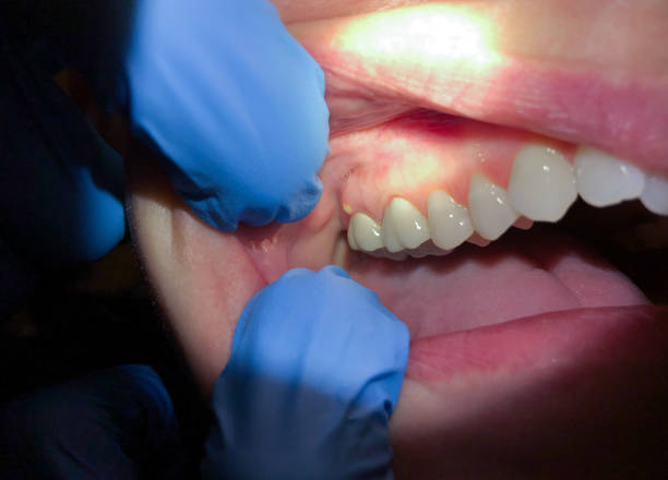 Best Emergency Gum Pain Relief  in Columbia, SC